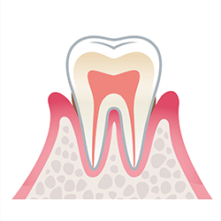 その2 ＜歯肉炎＞